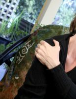 Причины возникновения болей в суставах и их лечение