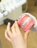 Керамические брекеты: интервью со стоматологом-ортодонтом