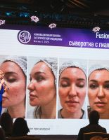 Umetex Aesthetics представила передовые технологии в области косметологии на ИШЭМ-2025
