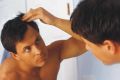 Как победить облысение?