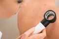 Черные точки на спине – откуда берутся и как от них избавиться?