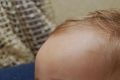 Необходимость прикорма детей на первом году жизни