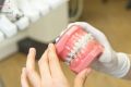 Керамические брекеты: интервью со стоматологом-ортодонтом