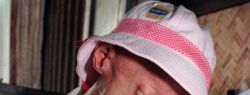 Самые странные заболевания, известные человеку