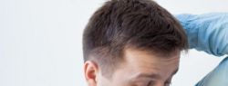 Повышенная потливость организма – как быстро решить проблему?