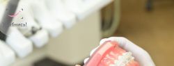 Керамические брекеты: интервью со стоматологом-ортодонтом